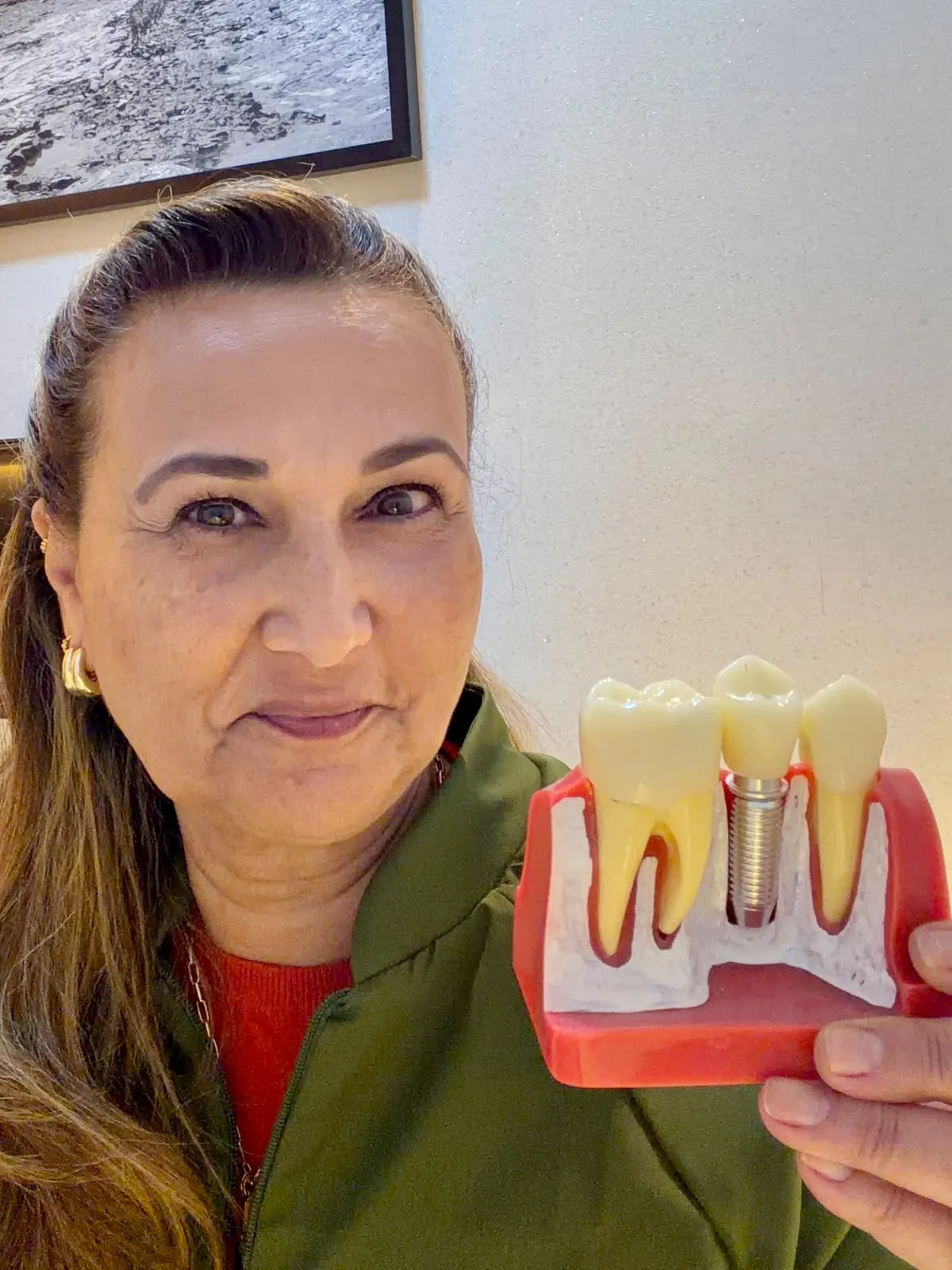 Dra. Cristiane Almeida mostrando um modelo em corte com um implante dentário posicionado entre dois dentes naturais